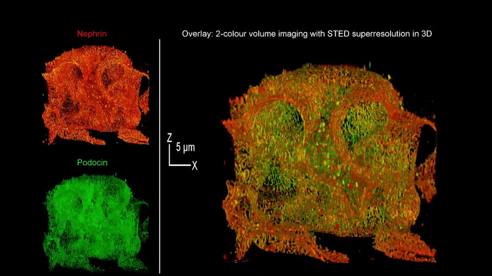 Two-color EASY3D volume of a cleared adult rat kidney sample
